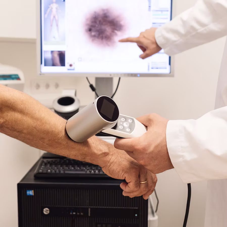 Hautkrebs Screening Dermatologie Düsseldorf
