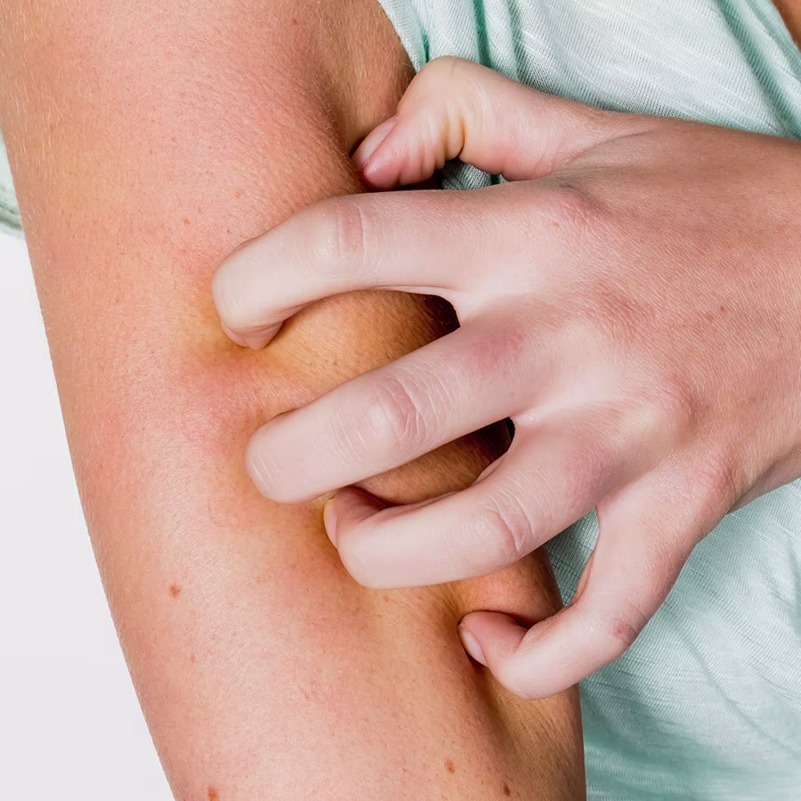 Allergische Reaktion