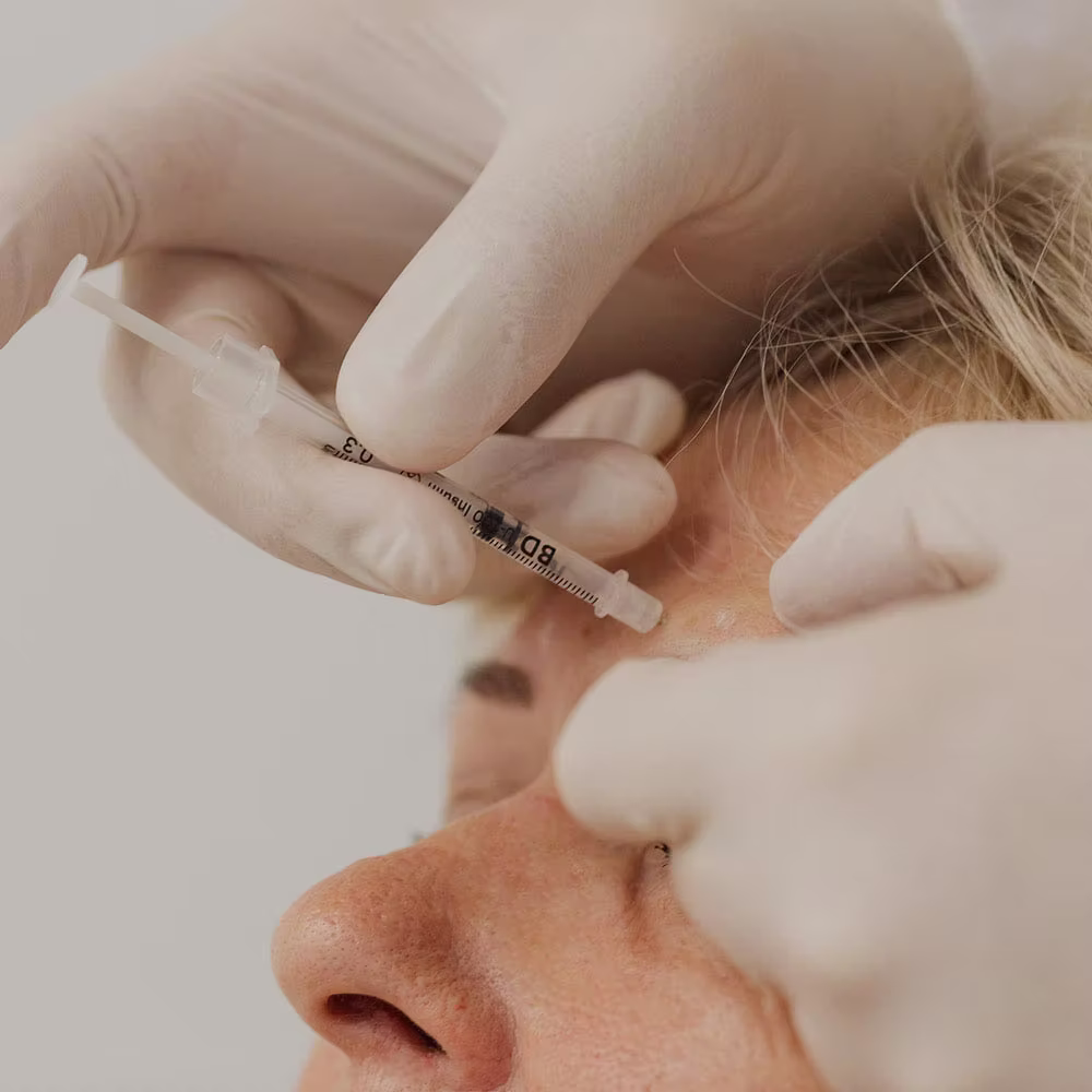 Botoxbehandlung zur gezielten Faltenbehandlung im Gesicht